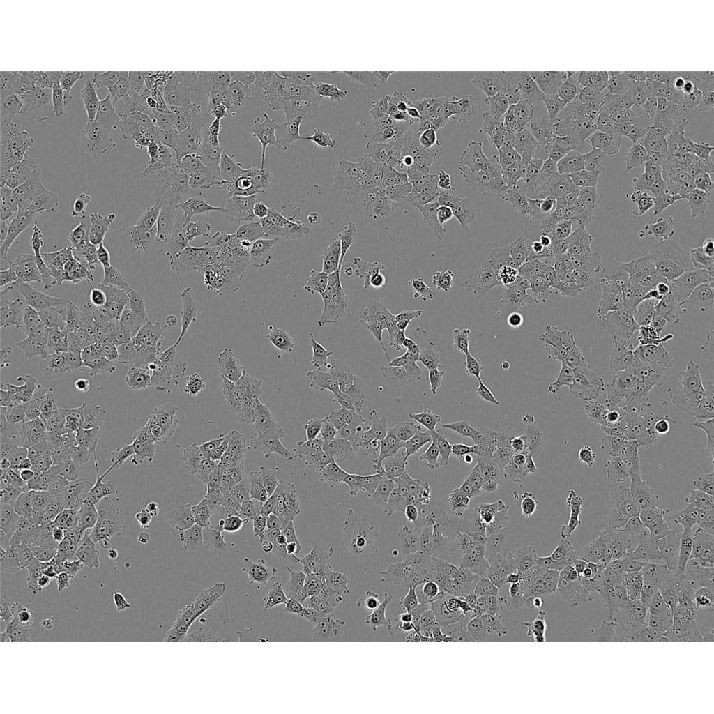 NCIH661 Cells#人大细胞肺癌细胞系复苏中心|完全培养基|STR图谱