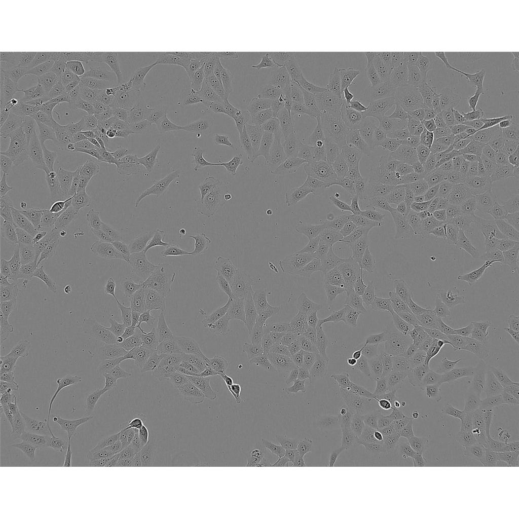 b.End3 Cells#小鼠脑内皮瘤细胞系复苏中心|完全培养基|STR图谱