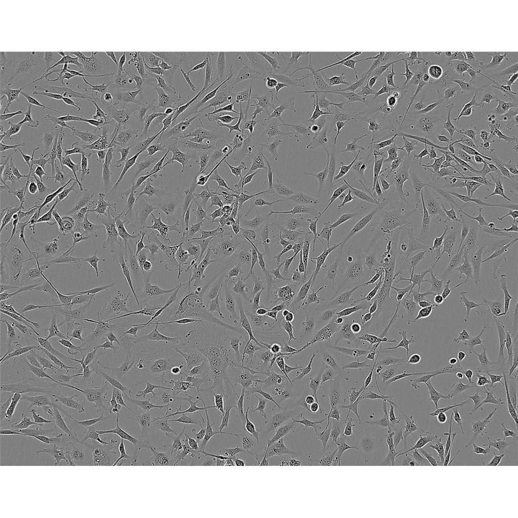 U-2OS Cells#人骨肉瘤细胞系复苏中心|完全培养基|STR图谱