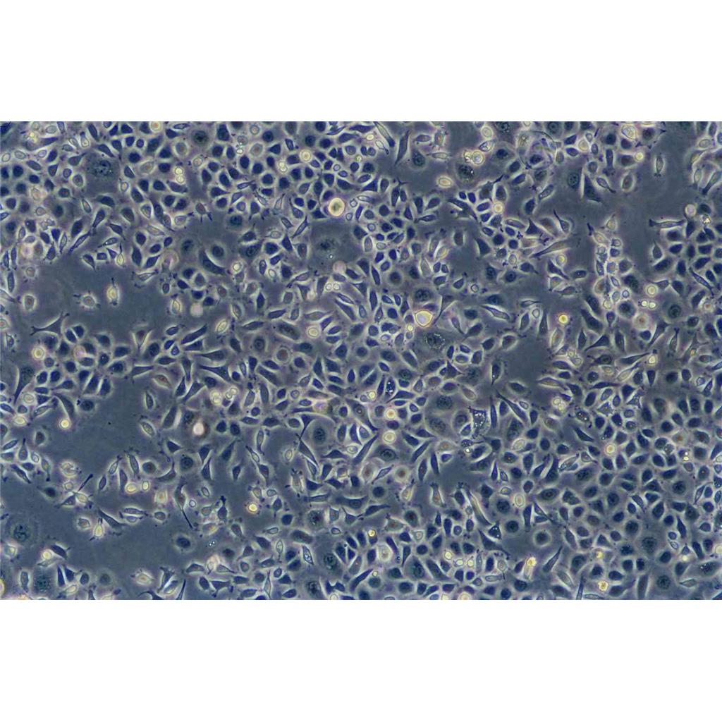 D324 Med Cells#人脑髓母细胞瘤细胞系复苏中心|完全培养基|STR图谱