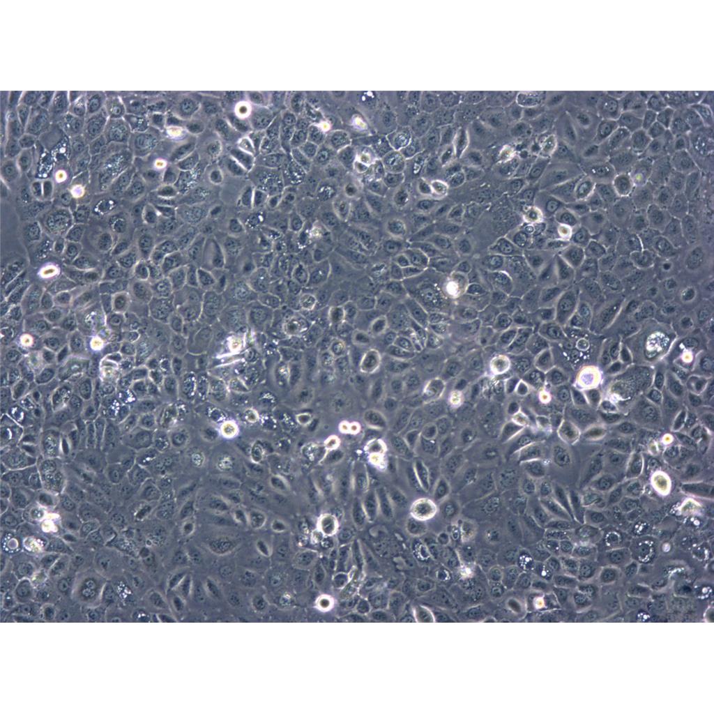 mda-MB468 Cells#人乳腺癌细胞系复苏中心|完全培养基|STR图谱