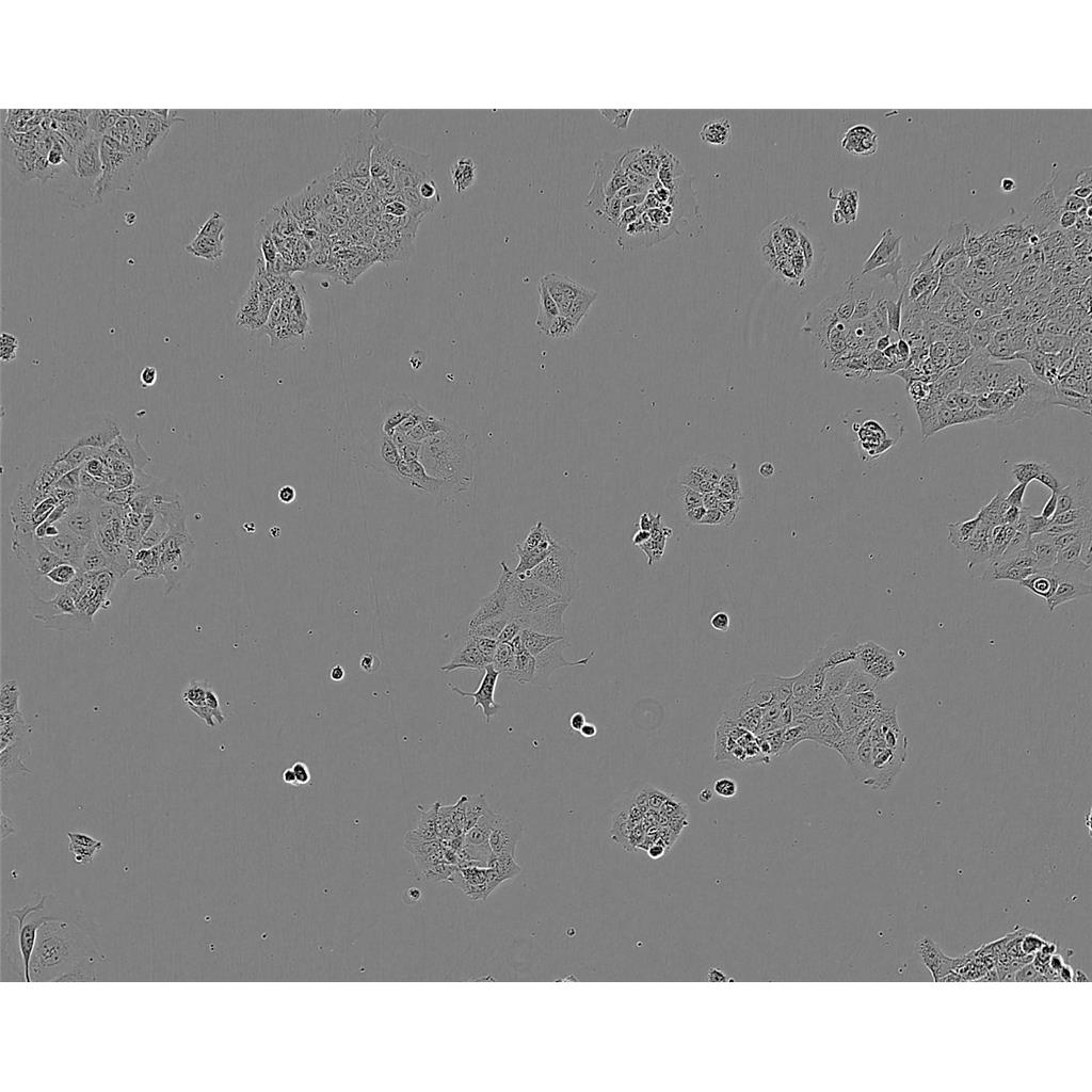 A431/P Cells#人皮肤鳞癌细胞系复苏中心|完全培养基|STR图谱