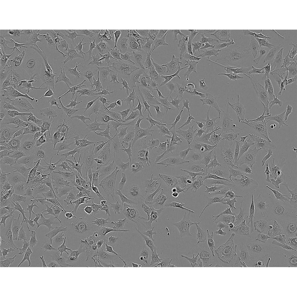 NCI-SNU-387 Cells#人肝癌细胞系复苏中心|完全培养基|STR图谱