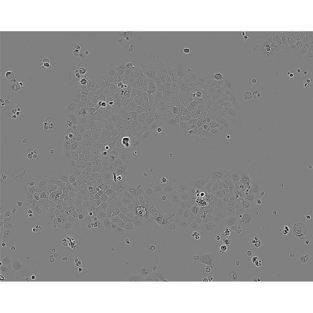 HCC-94 Cells#人子宫鳞癌细胞系复苏中心|完全培养基|STR图谱