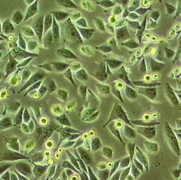 Circinella Lacrymispora