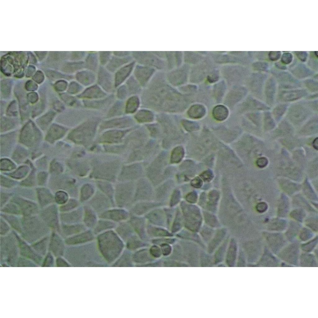 COLO320 DM Cells#人结直肠腺癌细胞系源头种子库|培养基|STR图谱