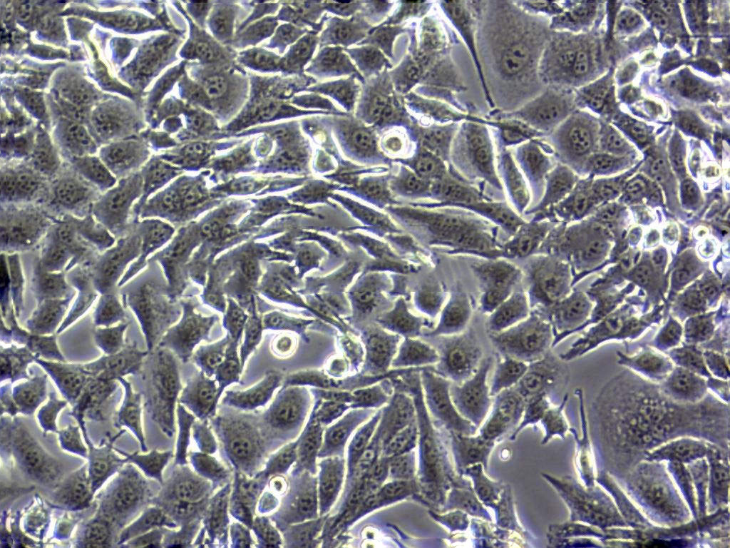 CA-OV-3 Cells#人卵巢癌细胞系源头种子库|培养基|STR图谱