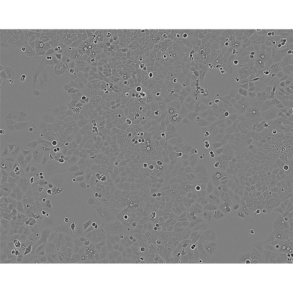 COLO320DM Cells#人结直肠腺癌细胞系源头种子库|培养基|STR图谱