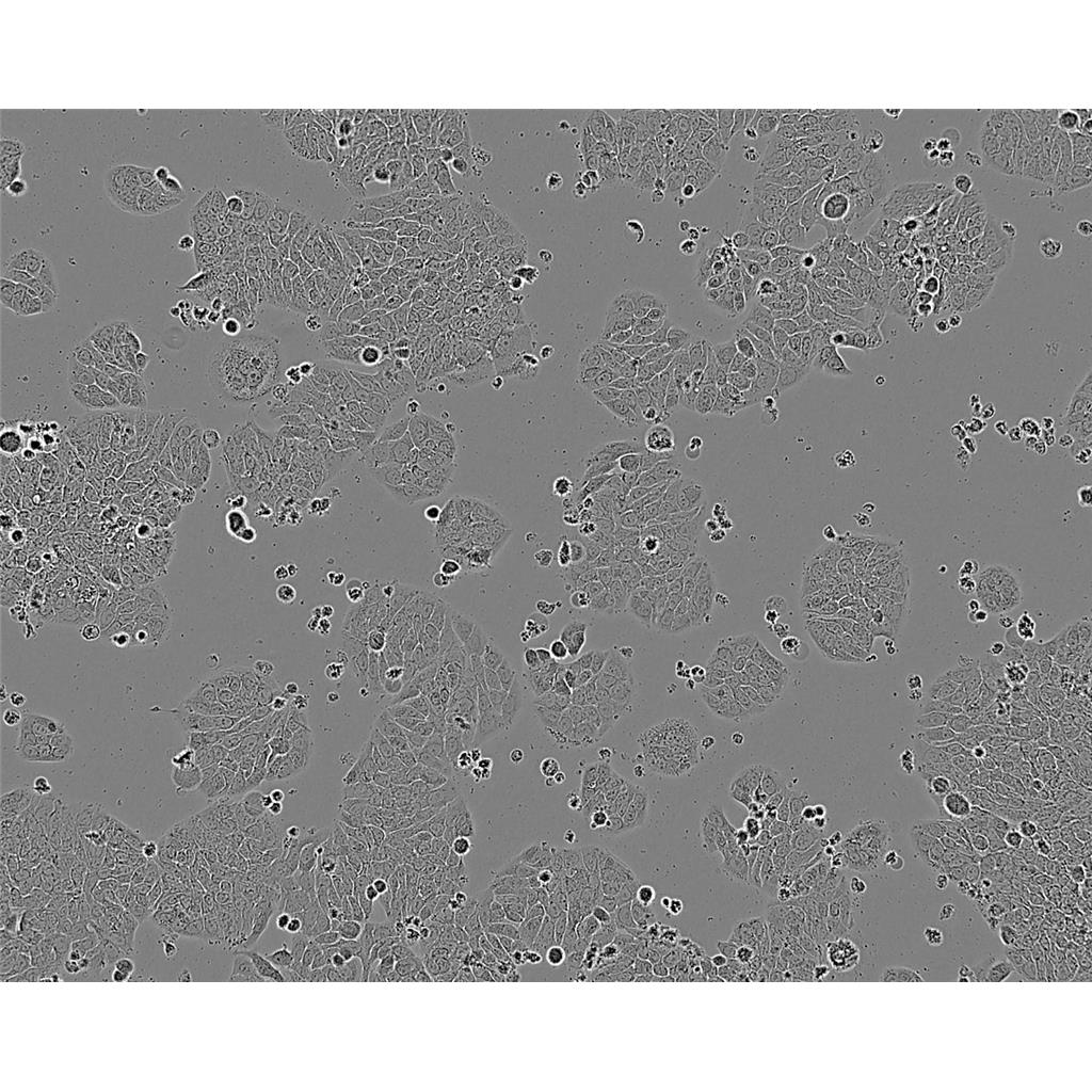 NIHOVCAR3 Cells#人卵巢腺癌细胞系源头种子库|培养基|STR图谱