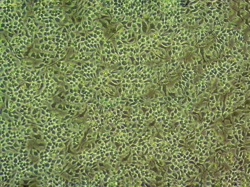 mda453 Cells#人乳腺癌细胞系源头种子库|培养基|STR图谱