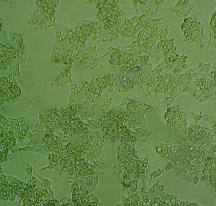 SUM-159 Cells#人乳腺癌细胞系源头种子库|培养基|STR图谱