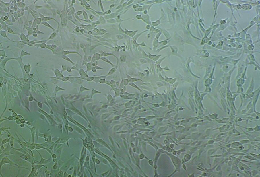 WM115-mel Cells#人黑色素瘤细胞系源头种子库|培养基|STR图谱