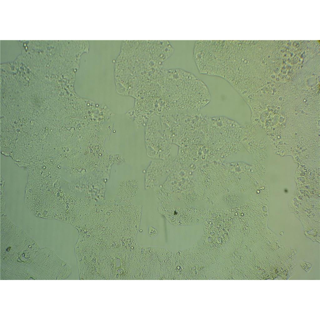 Y3Ag1.2.3 Cells#大鼠骨髓瘤细胞系源头种子库|培养基|STR图谱