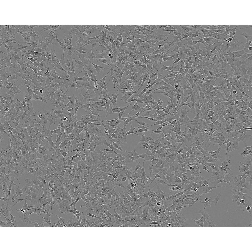 RT112人膀胱癌细胞代次低|培养基|送STR图谱