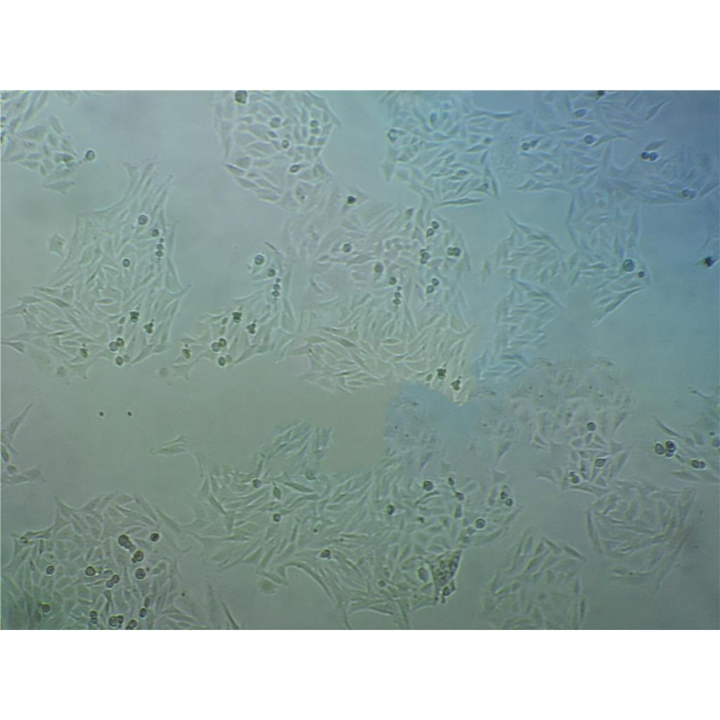 DU_145 Cells#人前列腺癌细胞系源头种子库|培养基|STR图谱