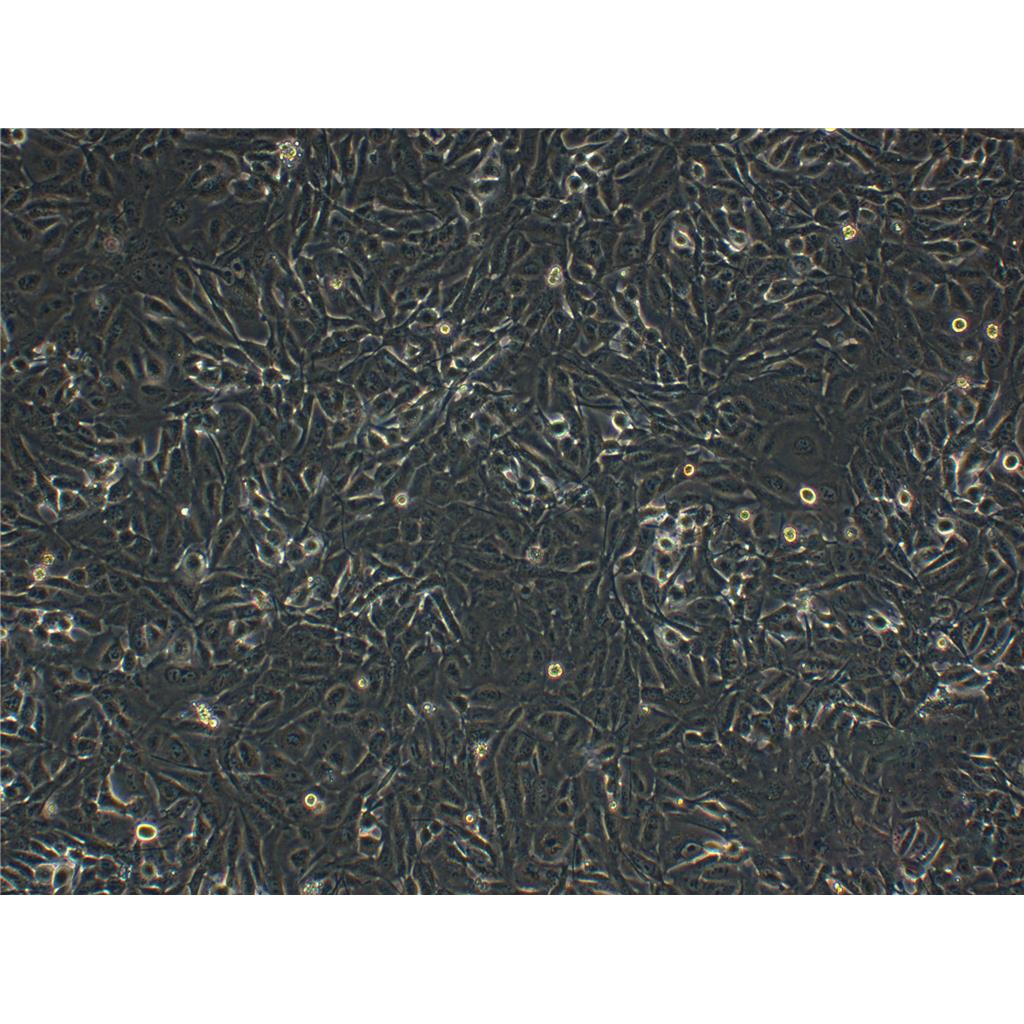 NIH:OVCAR3 Cells#人卵巢腺癌细胞系源头种子库|培养基|STR图谱