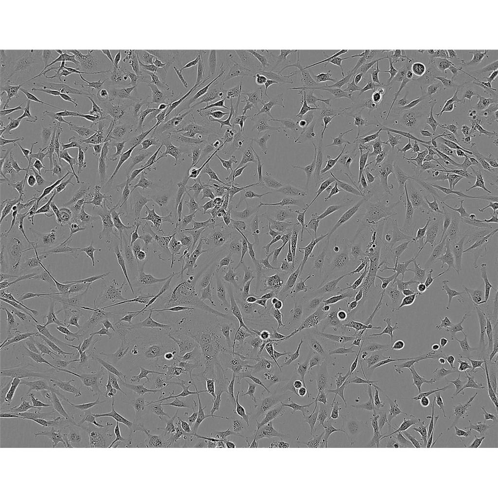 SK-MEL2 Cells#人恶性黑色素瘤细胞系源头种子库|培养基|STR图谱