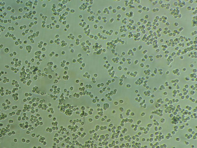 Human fetal lung fibroblast 1人肺成纤维细胞系保种库(附带STR基因图谱)