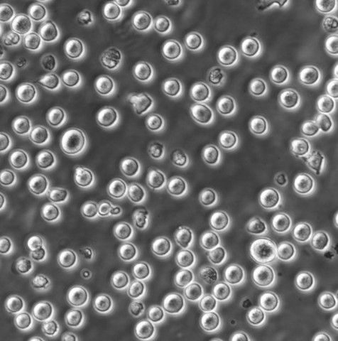 MT4 Cells人急性淋巴母细胞白血病悬浮细胞系(提供全部细胞STR鉴定图谱)