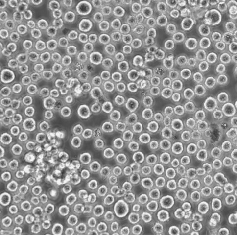 SUP-T1 Cells人T淋巴母细胞瘤悬浮细胞系(提供全部细胞STR鉴定图谱)