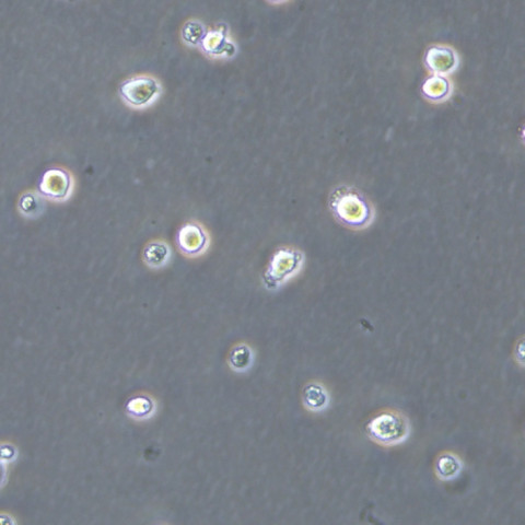 skm-1 Cells人急性髓系白血病悬浮细胞系(提供全部细胞STR鉴定图谱)