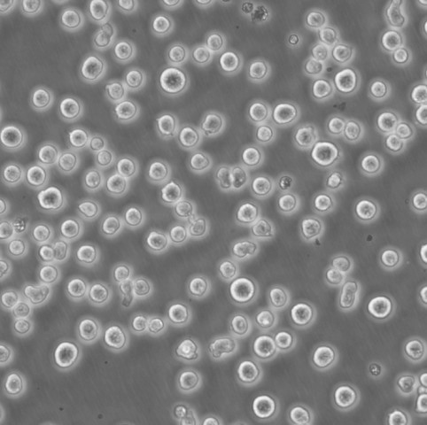 MEC-1 Cells人慢性B细胞白血病悬浮细胞系(提供全部细胞STR鉴定图谱)