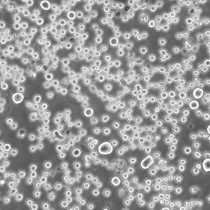 Reh Cells人急性非B非T淋巴细胞白血病悬浮细胞系(提供全部细胞STR鉴定图谱)