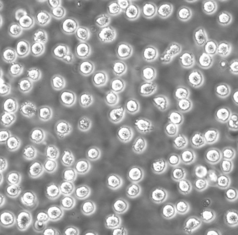 U2932人B细胞淋巴瘤细胞实验室|已有STR图谱