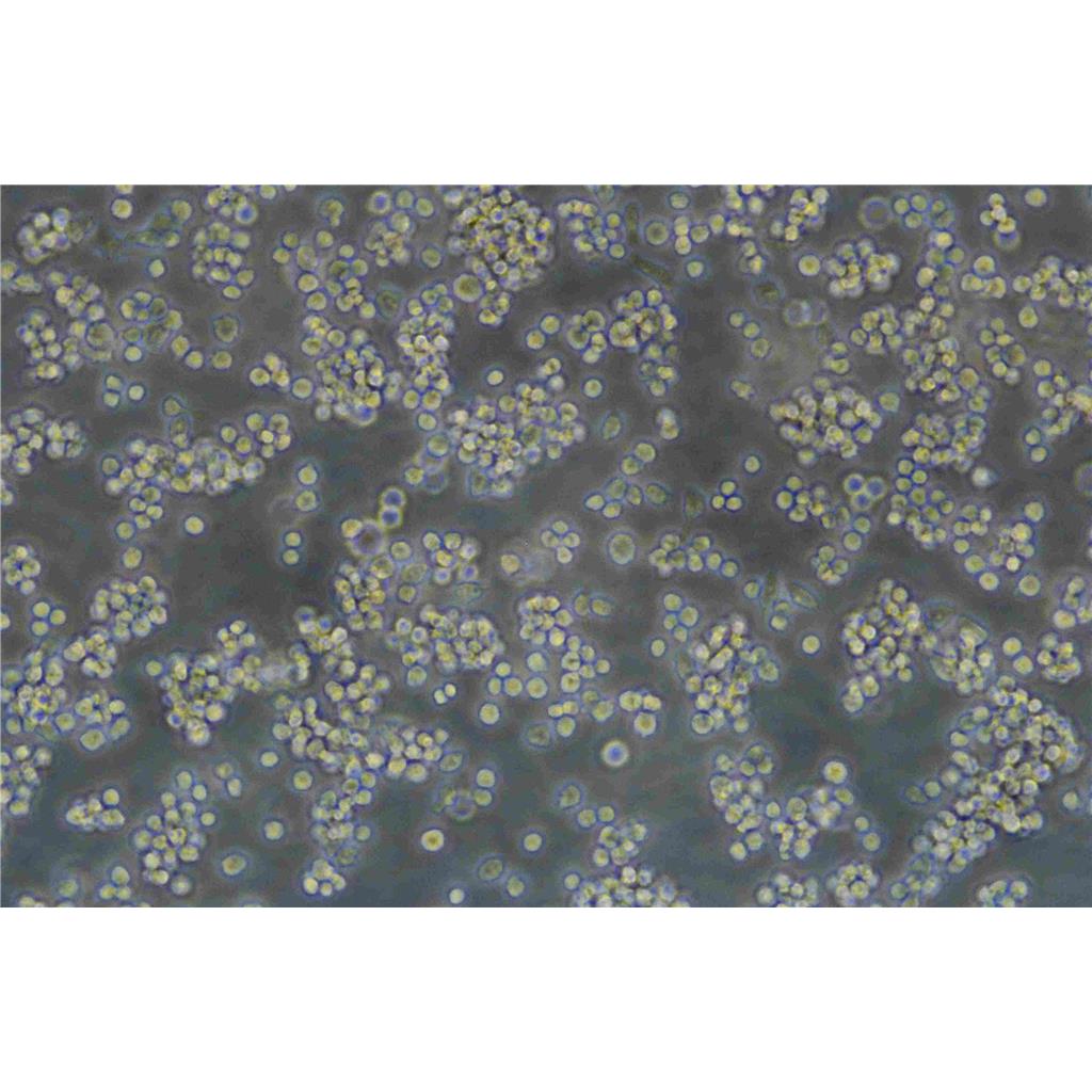 MOLP-8人多发性骨髓瘤细胞实验室|已有STR图谱