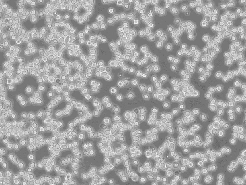 OCI-LY1人B细胞淋巴瘤细胞实验室|已有STR图谱