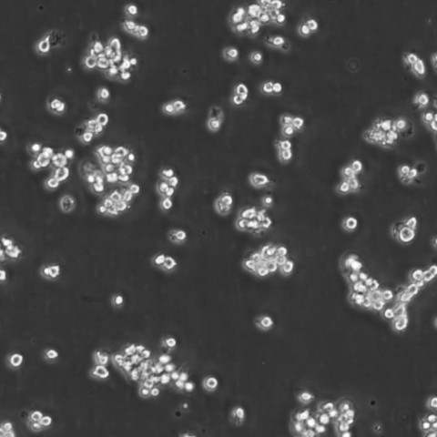 CEM/C1 Cells人急性淋巴细胞白血病悬浮细胞系(提供全部细胞STR鉴定图谱)