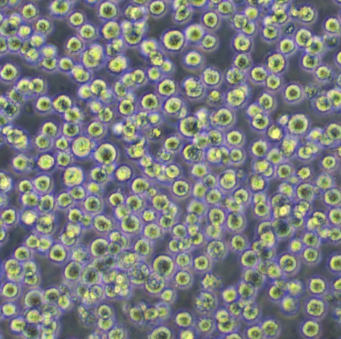 CA 46 Cells人burkitt淋巴瘤可传代细胞系(送STR鉴定图谱)