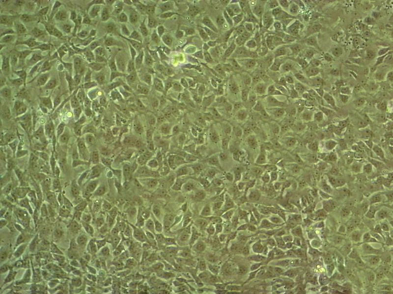 SW.620 Cells#人结肠癌细胞系源头种子库|培养基|STR图谱