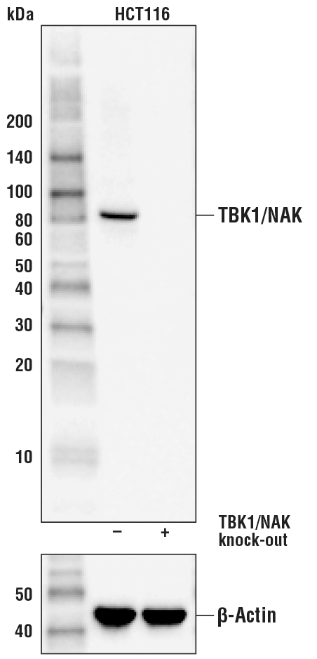 TBK1/NAK (D1B4) 兔单抗