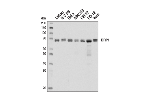 DRP1 (D6C7) 兔单克隆抗体