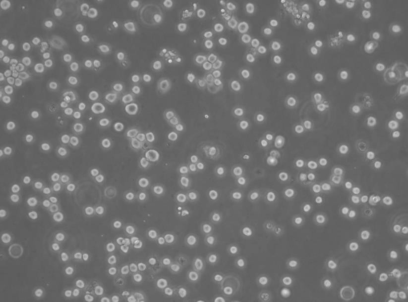 WSU-DLCL2 Cells人弥漫大B淋巴瘤悬浮细胞系(赠送STR基因图谱)