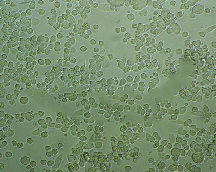 Hs746T人胃癌细胞实验室|已有STR图谱