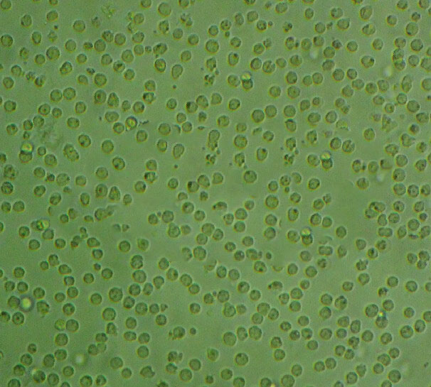 U251MG Cells#人神经胶质瘤细胞系保种中心(通过STR鉴定)