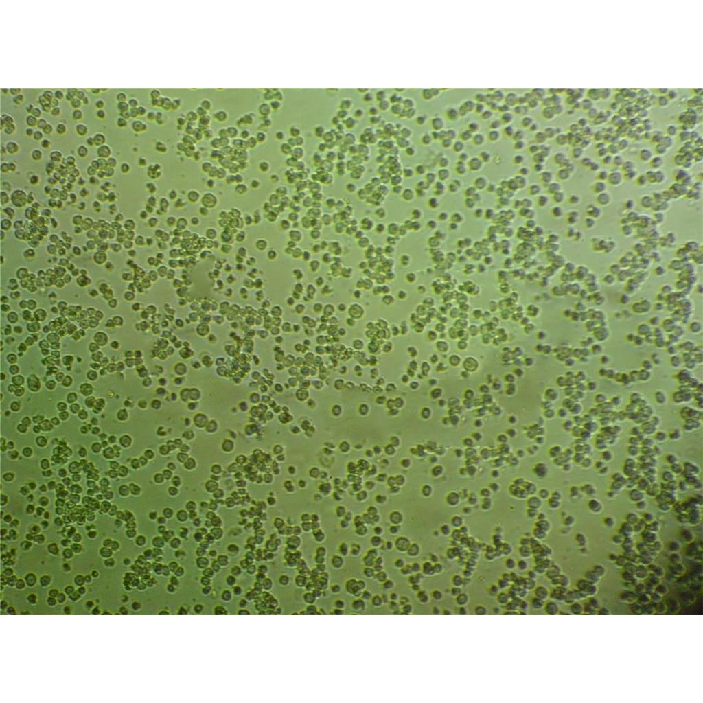 CCRFCEM Cells#人急性淋巴细胞白血病T淋巴细胞系保种中心(通过STR鉴定)