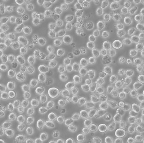 NCI-H929人骨髓瘤复苏细胞|STR基因图谱