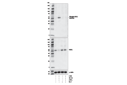 Phospho-MLKL (Ser345) (D6E3G) 兔单克隆抗体