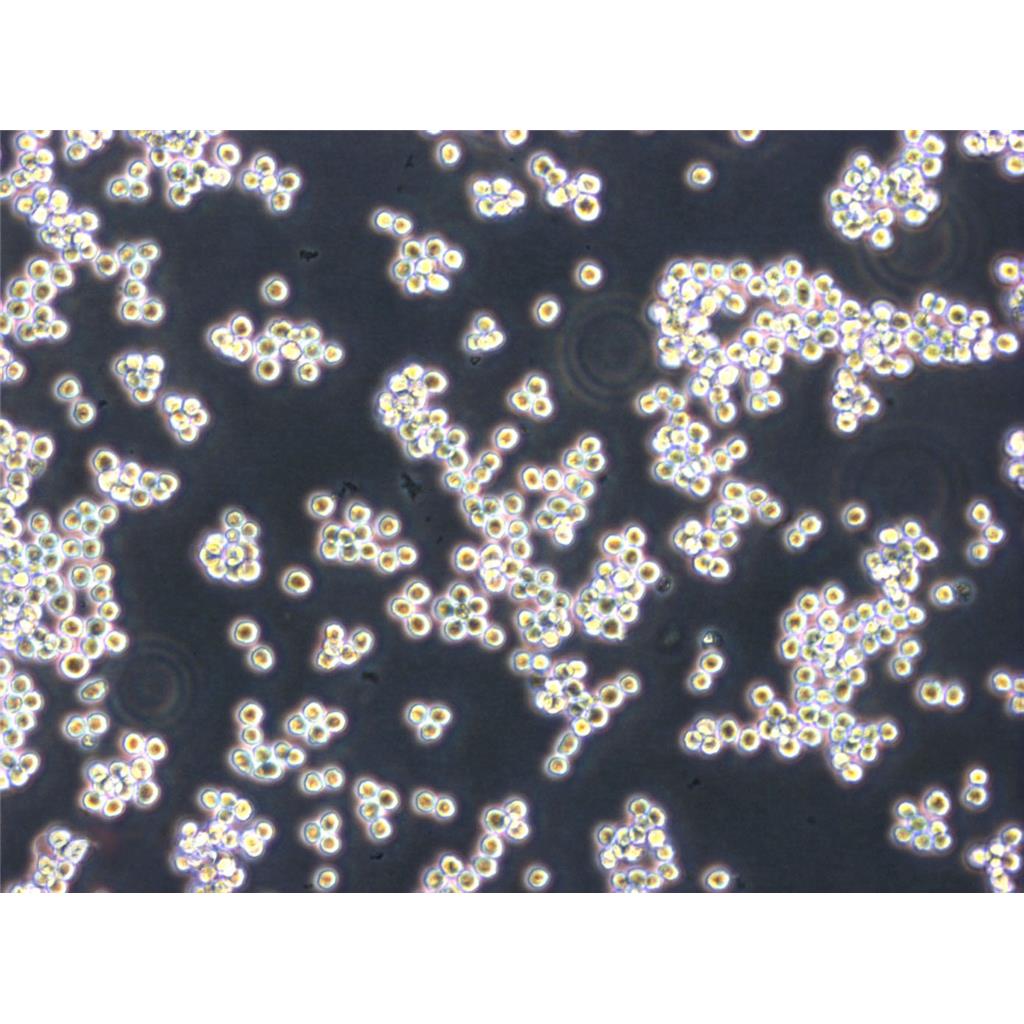 COLO_320DM Cells#人结直肠腺癌细胞系活性强|培养基|送STR图谱