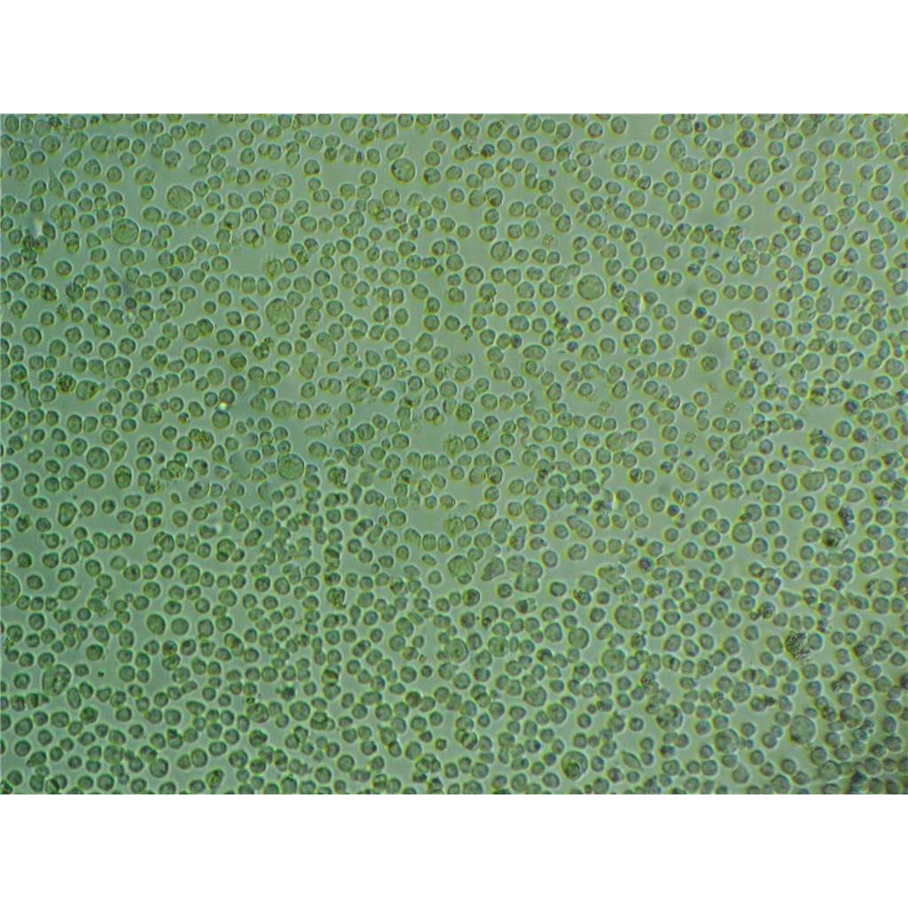 MHCC97-H Cells#高转移人肝癌细胞系源头种子库|培养基|STR图谱