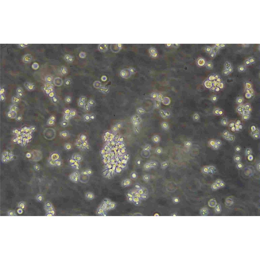 EJ-1 cells人膀胱癌细胞系