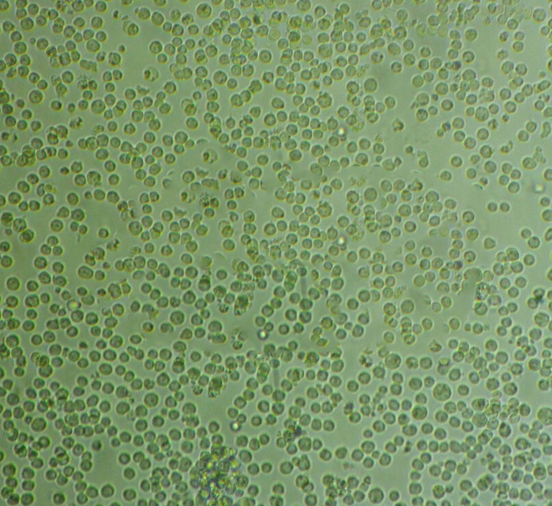 WERI-Rb-1 Cells#人视网膜神经胶质瘤细胞系源头种子库|培养基|STR图谱