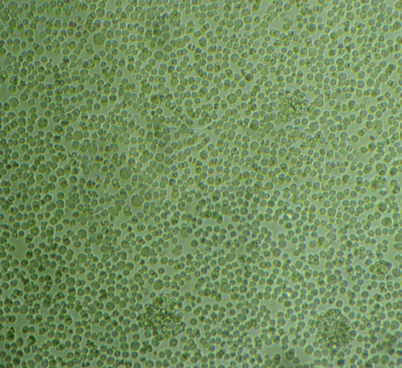 KYSE-140 Cells#人食管鳞癌细胞系复苏中心|完全培养基|STR图谱