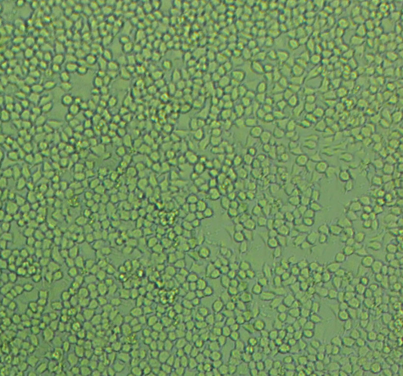 SVCT Cells#人乳腺上皮细胞系复苏中心|完全培养基|STR图谱