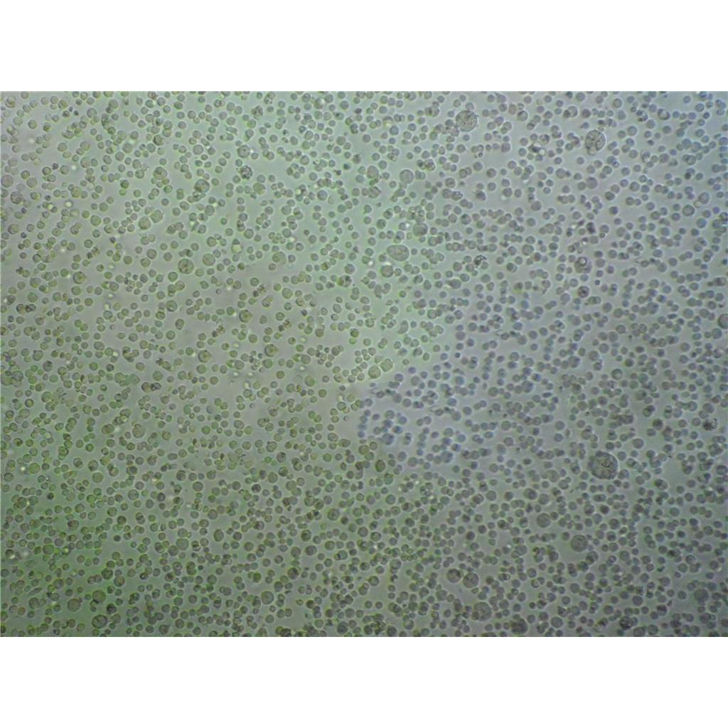 293FT Cells#人胚肾细胞系复苏中心|完全培养基|STR图谱