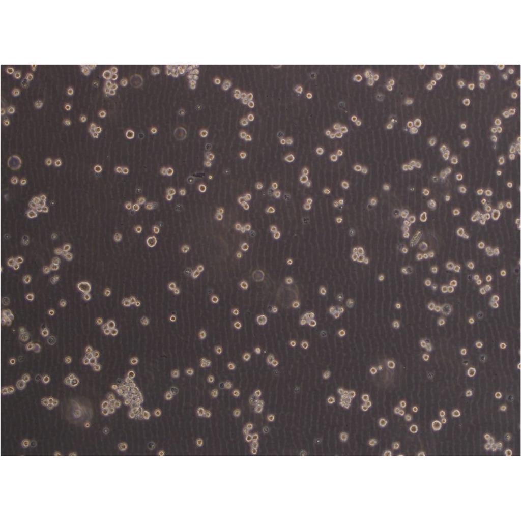 U-251MG-GFP Cells人神经胶质细胞瘤细胞长期复苏|带STR图谱