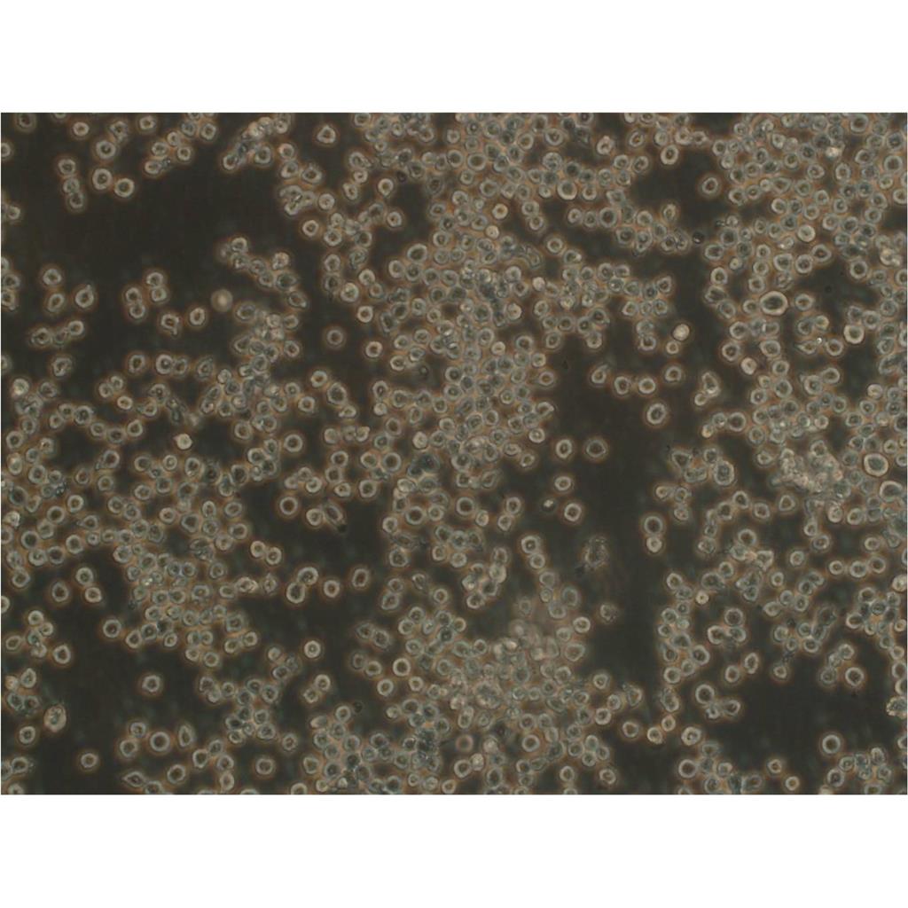 JHU-029 Cells人细胞|仅提供STR图谱